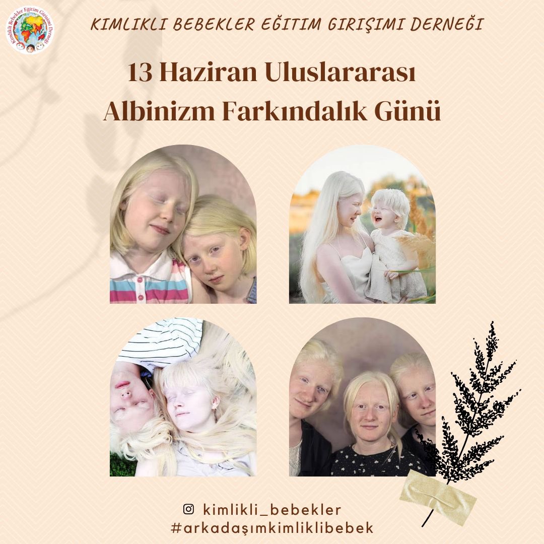 Herkese merhabalar 🙋🏼‍♀️🙋🏾🌍 Bugün 13 Haziran Dünya Albinizm Farkındalık Günü ✨ Kimlikli Bebekler Eğitim Girişimi olarak biz de albinizmin farkındayız ve zorluklara karşı birlikte güçlüyüz 🧚🏽‍♀️ <a href="/AlbinizmDernegi/">Albinizm Derneği</a> 

#arkadaşımkimliklibebek #zorluklarakarsıbirliktegüçlüyüz
#albinizm