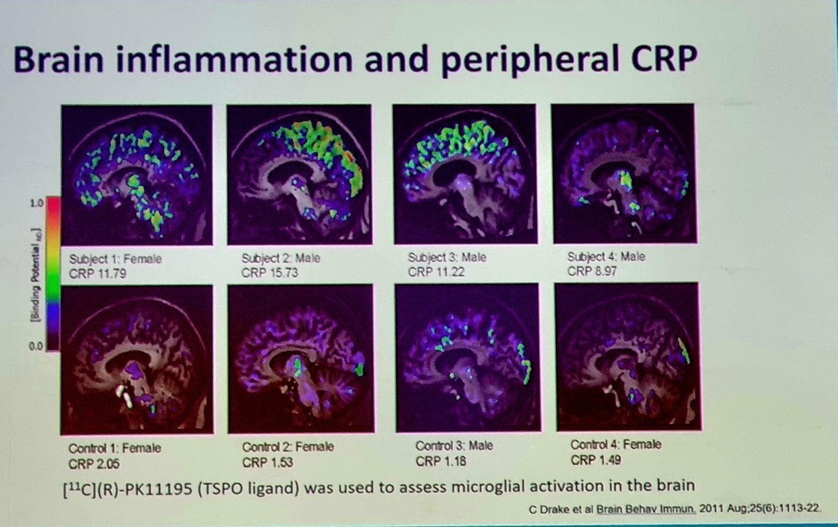 drALINAdima's tweet photo. RA and the brain (by C Edwards)
and yes, RA is rheumatoid arthritis .... we are still learning about "systemic"
new data for MTX as gold standard
Day 4 - 13th International #Congress on #Autoimmunity2022
#TogetherInAthens https://t.co/g5z4v7aVkR