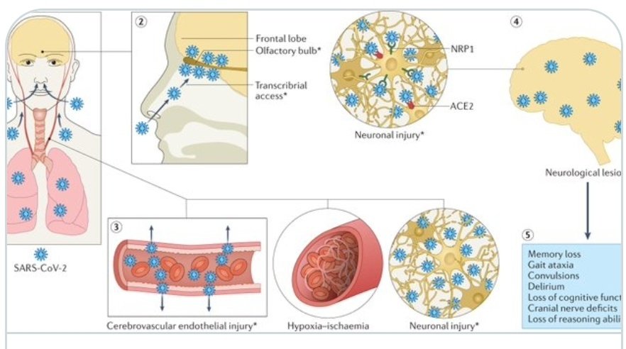 AMannanBaig's tweet photo. The paper on the mechanisms underlying NeuroCOVID in Long-COVID and possible remedies has been completed and ready for submission tonight. Will keep my followers updated on this. 
Image below shows how SARSCoV2 could persist at sites of viral loads in Long-COVID https://t.co/znn1hdxCBb
