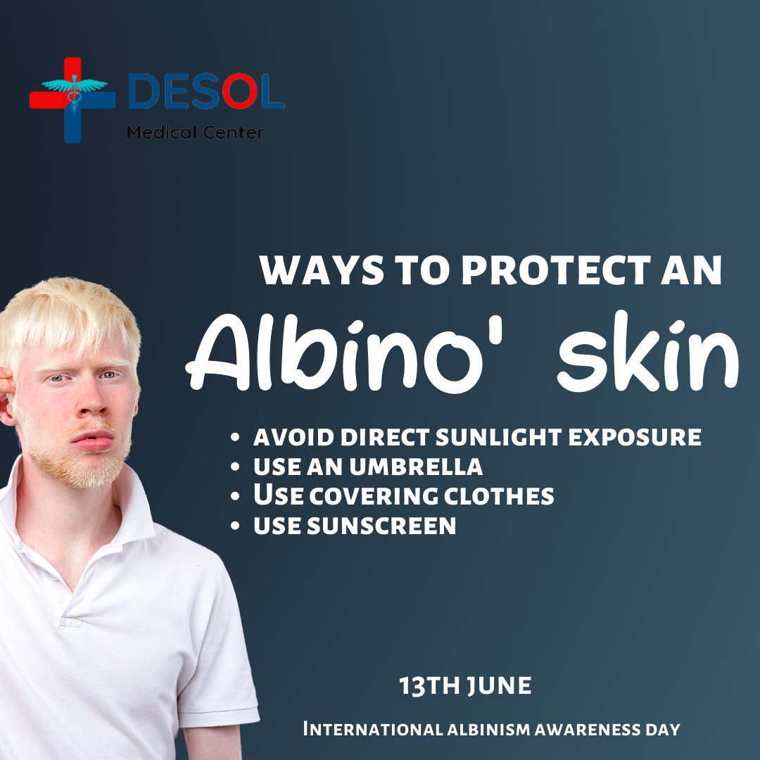 DesolMedical's tweet photo. Being an ALBINO is not a curse. It's not strange. They are people. Don't discriminate against them. It's okay to be different!
See an interview at https://t.co/VVOV9aG6pL
#worldalbinism
#WHO
#healthcare
#nigeria
#healthylifestyle
#health
#albino
#AlbinismDay
#albinismisbeautiful https://t.co/Jd5oA8QcgI