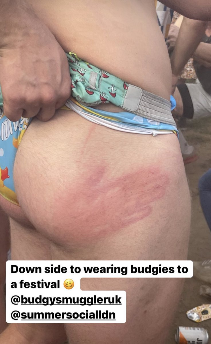 CHEEKY RUGBY 🍑🏉🔥 tweet media