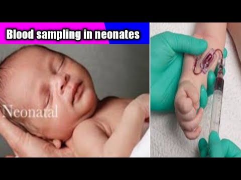 PhlebotomyTechC's tweet image. how to draw blood tasting from neonates #bloodsampling #bloodsample #health #nidhicreation 2012 phlebotomytechniciancertification.org/how-to-draw-bl…