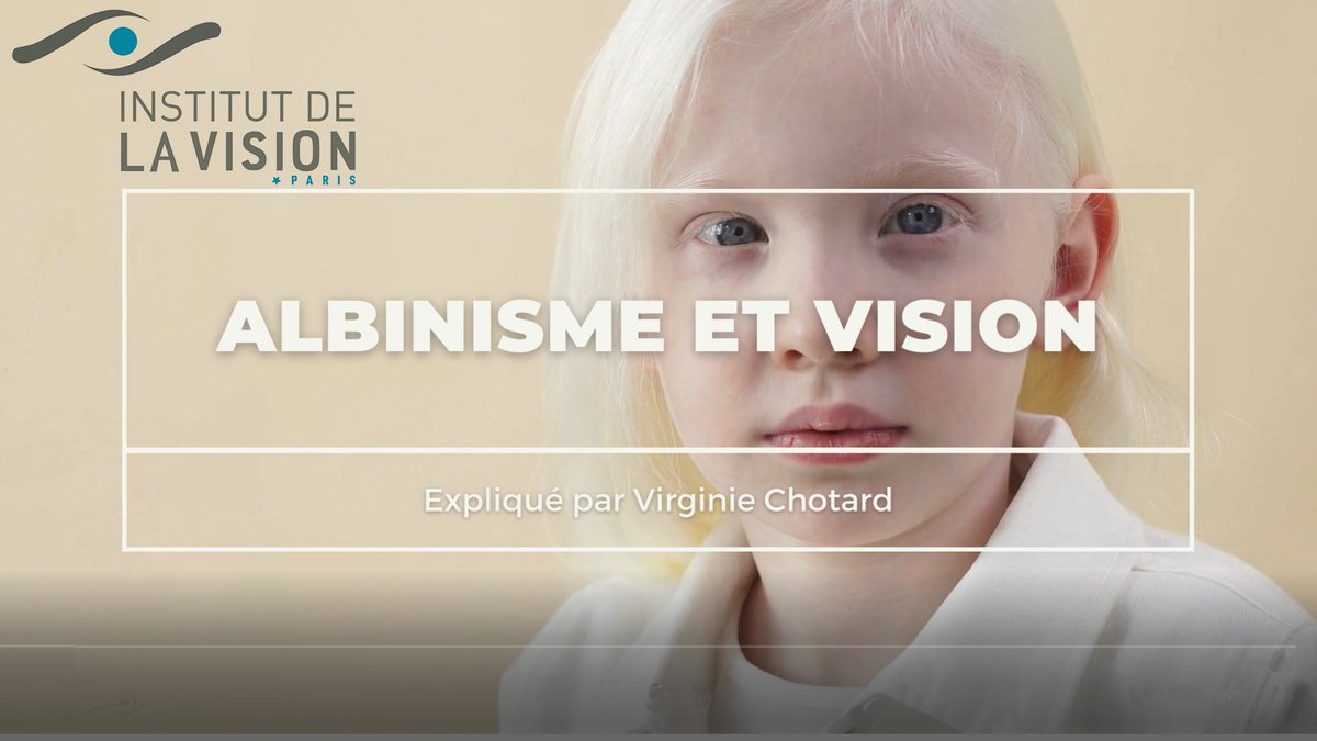 InstVisionParis's tweet photo. 📢Journée international de sensibilisation à l'#albinisme
L'albinisme et la vision par @VirginieChotard PhD Student @Sorbonne_Univ_  @InstVisionParis @AlainChedotal @RebsamA
#genespoir #photophobie #nystagmus #melanine #whitehair #borntoshine 
Video👉https://t.co/NMC9OMb0he https://t.co/p2E8eyNZNs