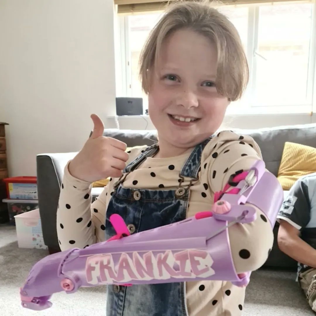 TeamUnLimbited's tweet photo. Say CHEESE! π§π
... I mean, THIS is what it's all about. β€οΈπ¦Ύ
#LimbDifference #3DPrinting #LimbDifferenceCommunity #Positivity https://t.co/pSgp2JPWJ0