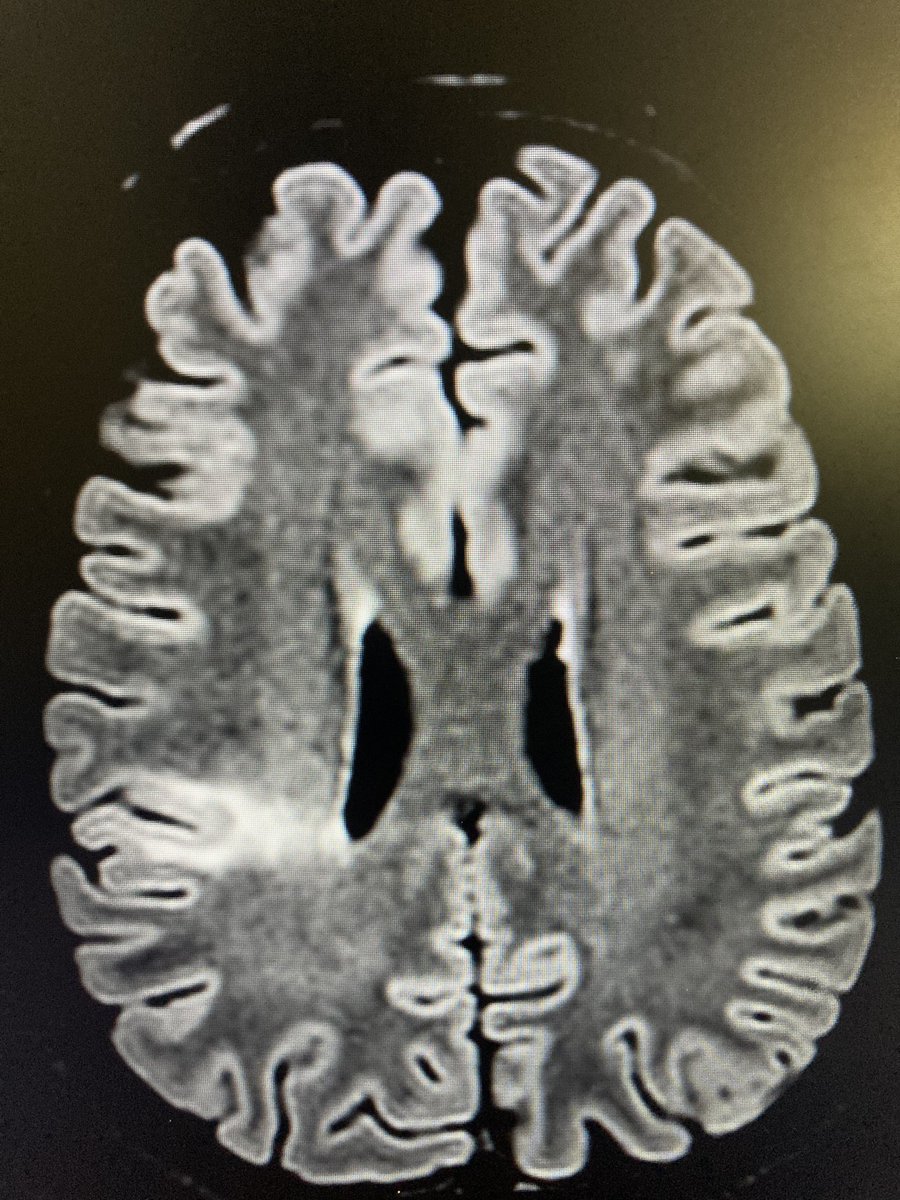 withoutscalpel's tweet photo. #Classicone #neurorad #MedTwitter https://t.co/qDz49cp9B0