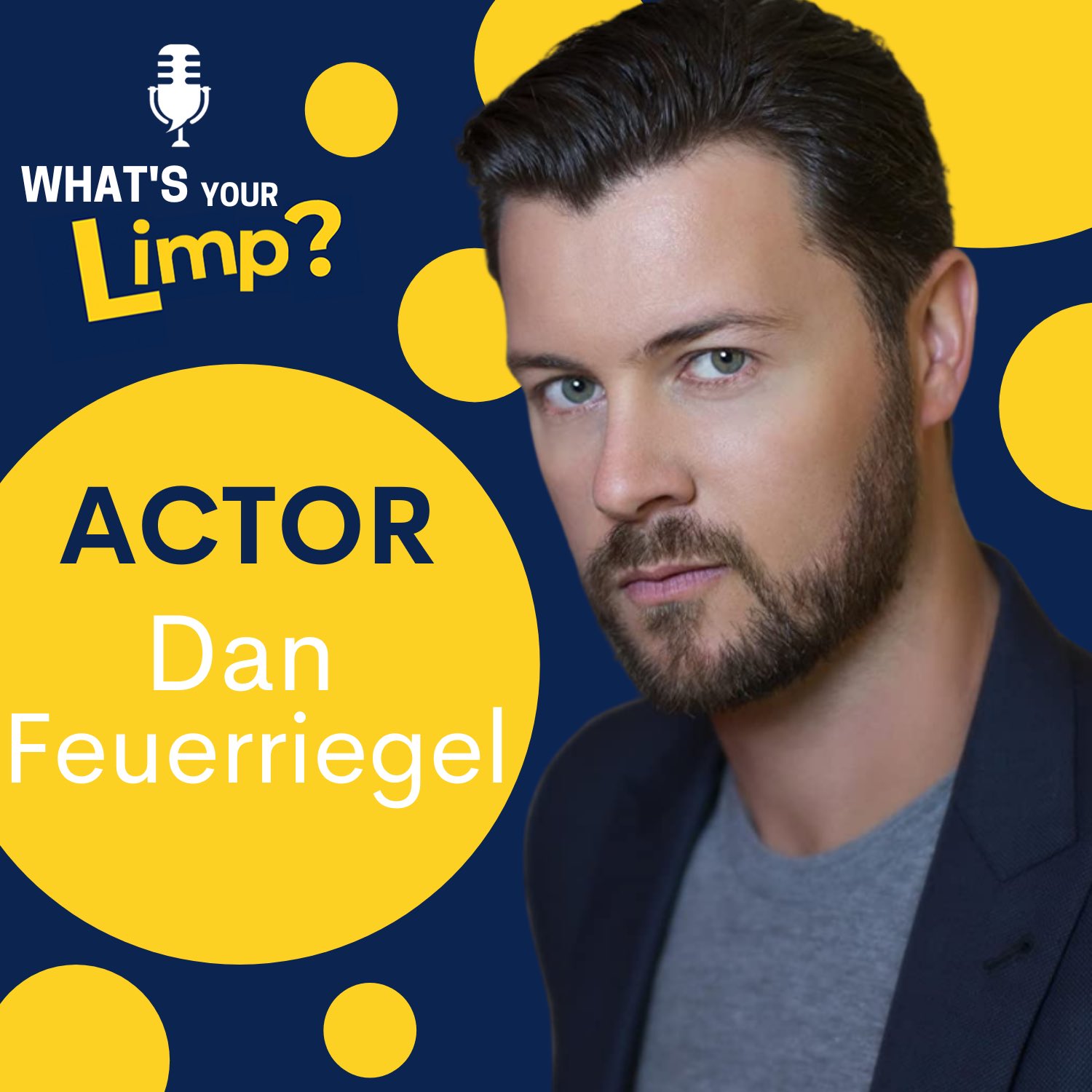 What’s Your Limp? on Twitter "Actor Dan Feuerriegel (Spartacus, Days