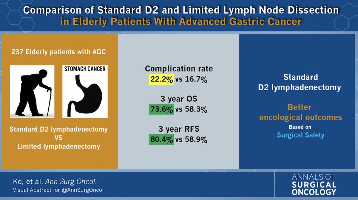 AnnSurgOncol's tweet image. Comparison of Standard D2 and Limited #LymphNodeDissection in Elderly Patients with Advanced #GastricCancer rdcu.be/cPkdz #VisualAbstract @McMastersKelly