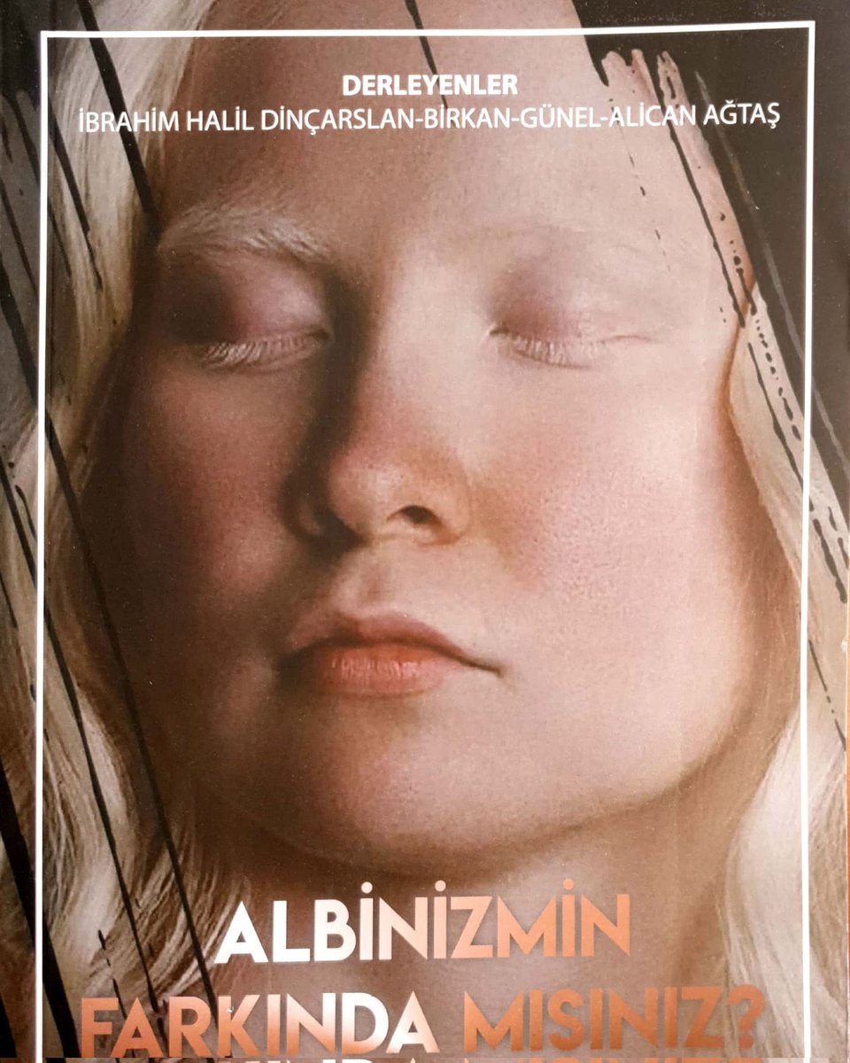 13 Haziran Albinizm'in farkındayız... #albinizm #AlbinismDay @ibrahimdinco27