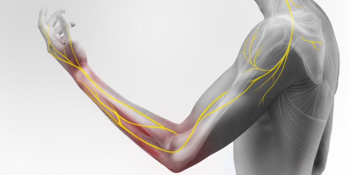 agewell's tweet image. If you have radiating symptoms in your arms, hands, legs, or feet, it may be nerve impingement. That is why our team is here to help you with NCS Testing! Contact us today for more! ☎️⤵️

Learn more: 1l.ink/5JB8FKF

#AgeWellPTandWellness #PhysicalTherapy #NCSTesting