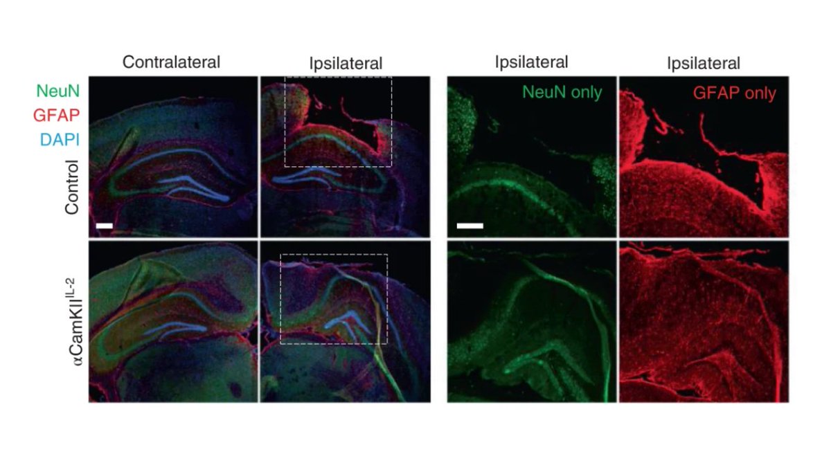 ImmunoPodcast's tweet photo. Our latest episode features #Tregs in #TraumaticBrainInjury.

A team at @KU_Leuven delivered IL-2 genes to the brain to protect against #neuroinflammation.

@ys_lidia @EmanuelaPasciu1 @LabListon @PascalBielefeld 

📝 @NatImmunol https://t.co/ChW4WBr6Cz
🎧 https://t.co/8QOgMpts8U https://t.co/U1K95COqAh