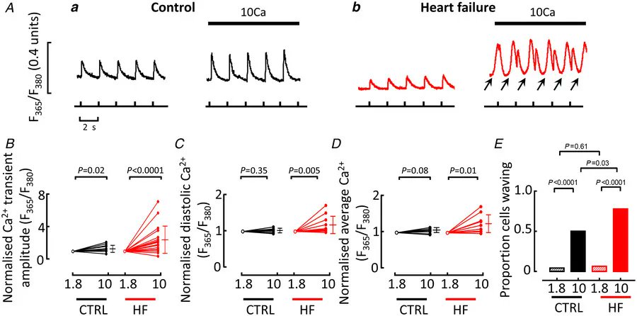 Journal of Physiology (@jphysiol) on Twitter photo New research on 'Interaction of background Ca2+ influx, sarcoplasmic reticulum threshold and heart failure in determining propensity for Ca2+ waves in sheep heart' from <a href="/OfficialUoM/">The University of Manchester</a> 👉 buff.ly/3aKP9rL New research on 'Interaction of background Ca2+ influx, sarcoplasmic reticulum threshold and heart failure in determining propensity for Ca2+ waves in sheep heart' from <a href="/OfficialUoM/">The University of Manchester</a> 👉 buff.ly/3aKP9rL