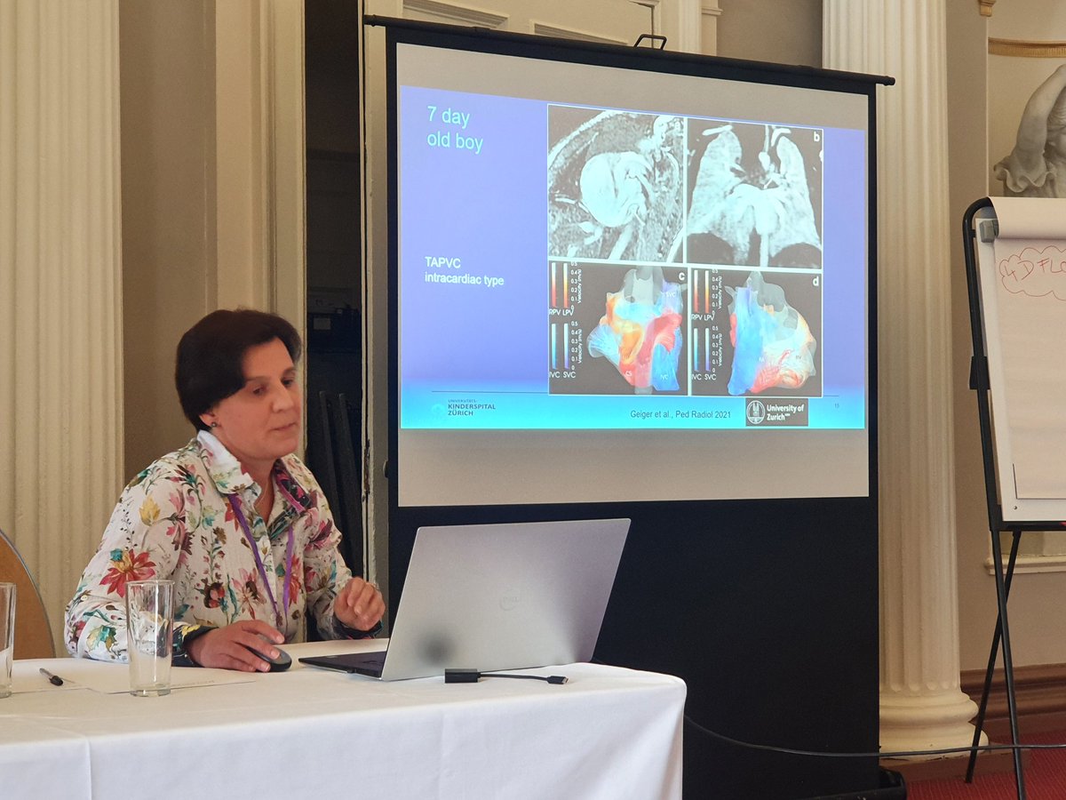 BissellMalenka's tweet photo. Amazing congenital cases presented by Julia Geiger showing benefits of #4DFlowCMR https://t.co/AfEwkHJVqg