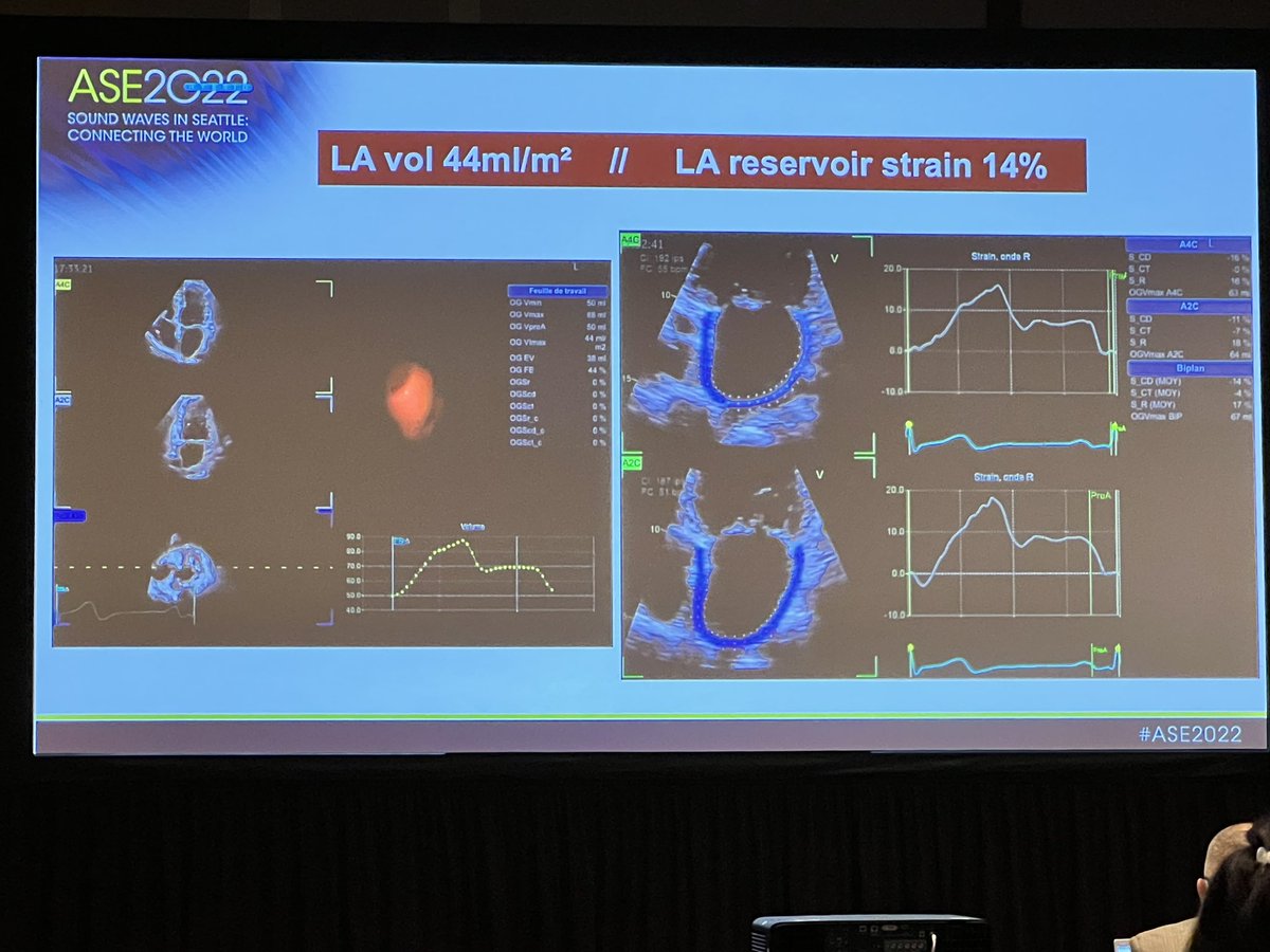 Are you doing LA strain routinely? #ASE2022 @AllanLKleinMD1