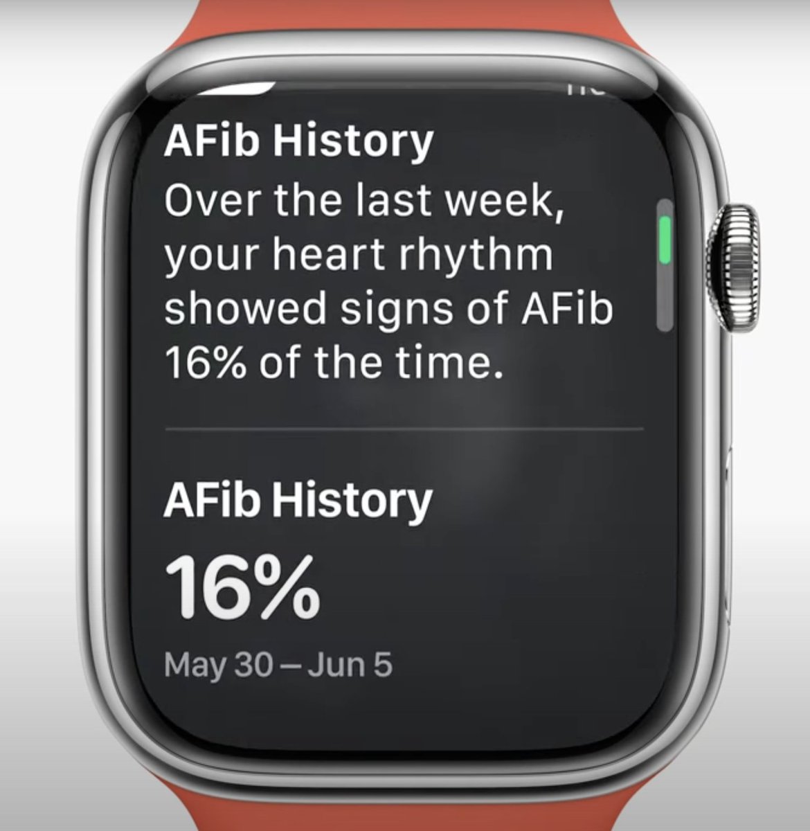 EJSMD's tweet photo. Info on AppleWatch AF burden:
 
✳️FDA 510(k) cleared
✳️PPG based
✳️Coming this fall in WatchOS9
✳️<1% diff comp to FDA cleared alternative
✳️Post ablation monitoring cited as use case
✳️Graphs lifestyle correlates - sleep, wt, exercise, EtOH, mindfulness 
✳️PDF shareable

#EPeeps https://t.co/UdGjfxScYM