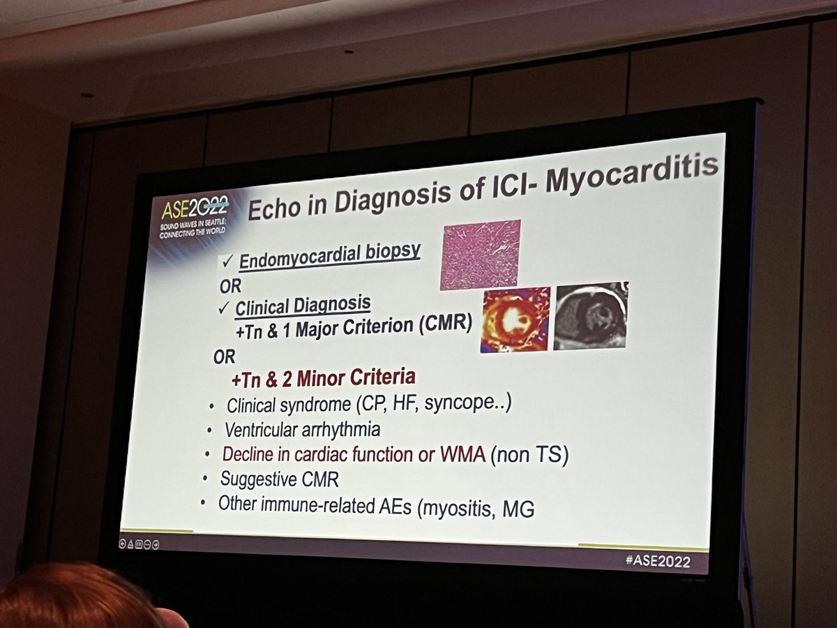 purviparwani's tweet photo. Excellent talk by @AnaBaracCardio on Immune check inhibitors for #CVImagers. Few points-
1. Toxicity not dose related
2. Double ICI ⬆️ risk
3. Diagnosis- #whyCMR myocarditis criteria is a major criteria as a noninvasive imaging modality
#ASE2022 @ASE360
@onco_cardiology https://t.co/ZnRcYVV6kN