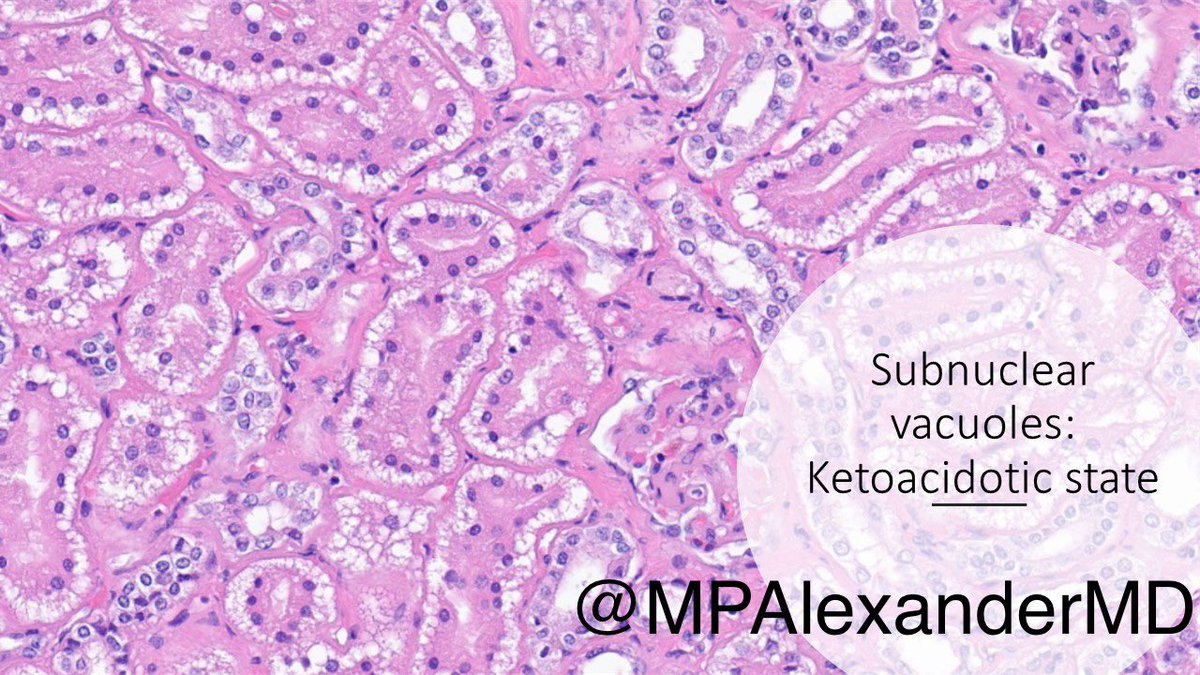 Now here is a pristine autopsy slide of the kidneys: can you even believe it? What’s your differential diagnosis? What are the next steps?