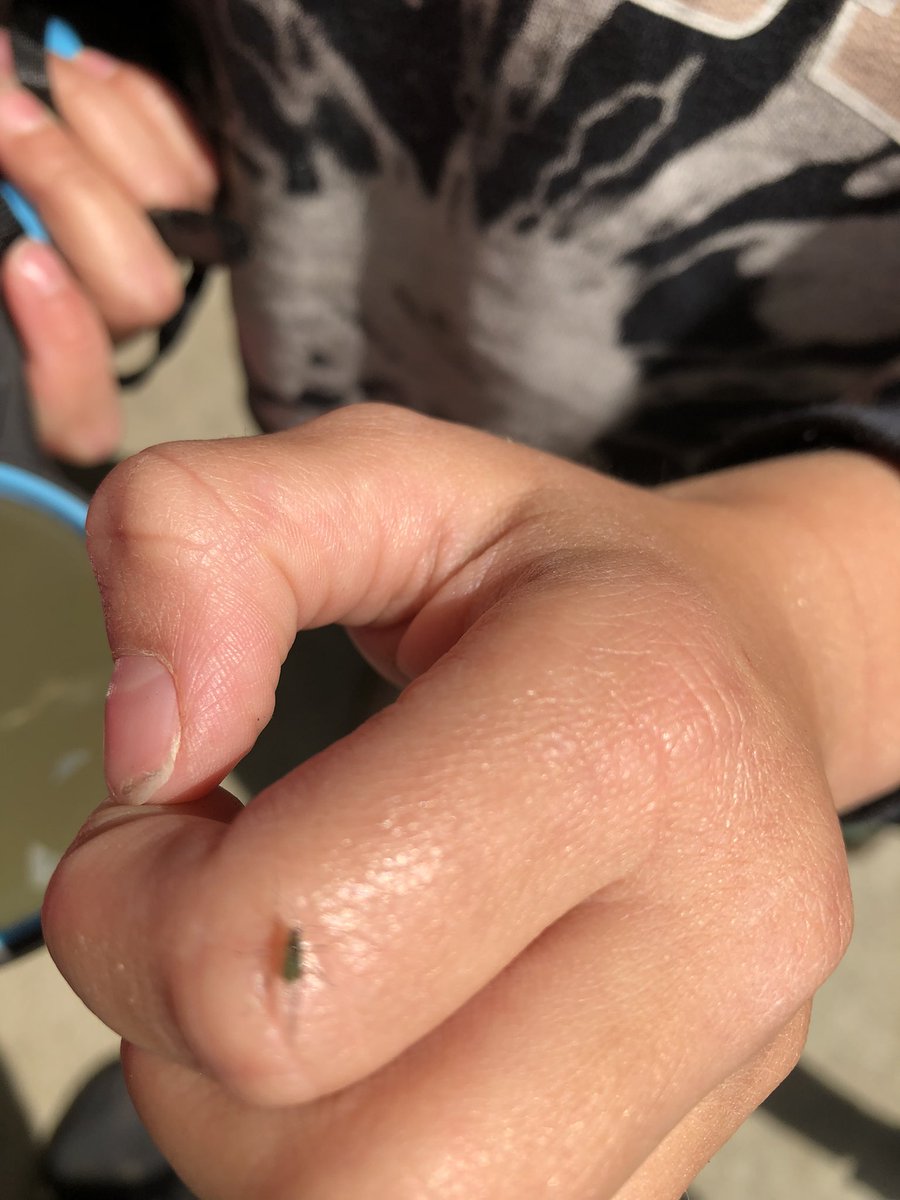 smusgrove2's tweet photo. Looking for insects all the bugs. What’s the difference? Ask a Kelvin Kindie! #bugpatrol #insects #scienceiseverywhere #sd40learns @LKCougars #kelvinkindies https://t.co/N7kGOGA2YG