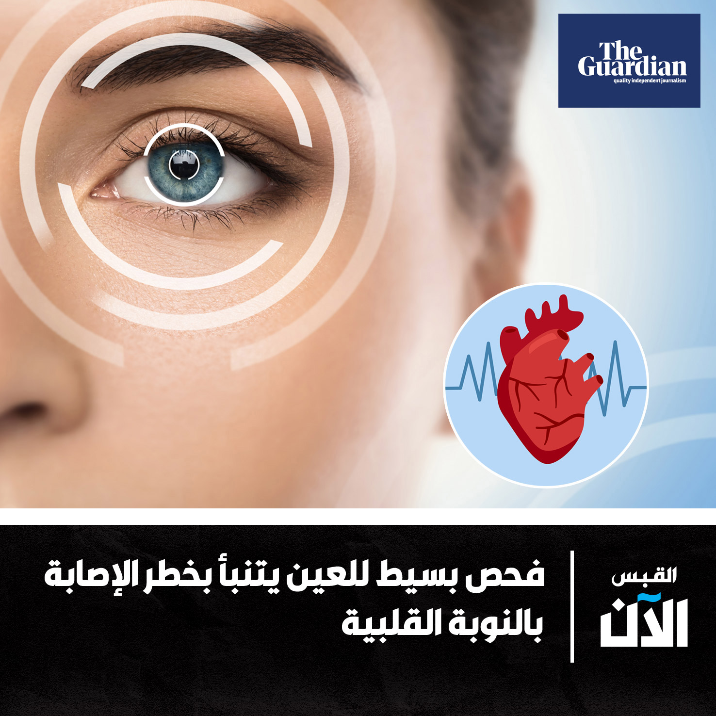 صحيفة القبس | فحص بسيط ل #العين يتنبأ بخطر الإصابة بالنوبة القلبية. قبل 5 سنوات من وقوعها