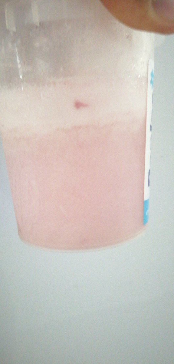 HPeteyra's tweet photo. E comprado este elado lo habri para probarlo luego lo e metido al refrigerador y miren esto se convirtio en puro hielo y no es un tema de temperatura esta porqueria que venden como helado y por cierto caro es agua saborizada y nada mas de helado no tiene nada, q robo dios https://t.co/WhTE4Vl8y5