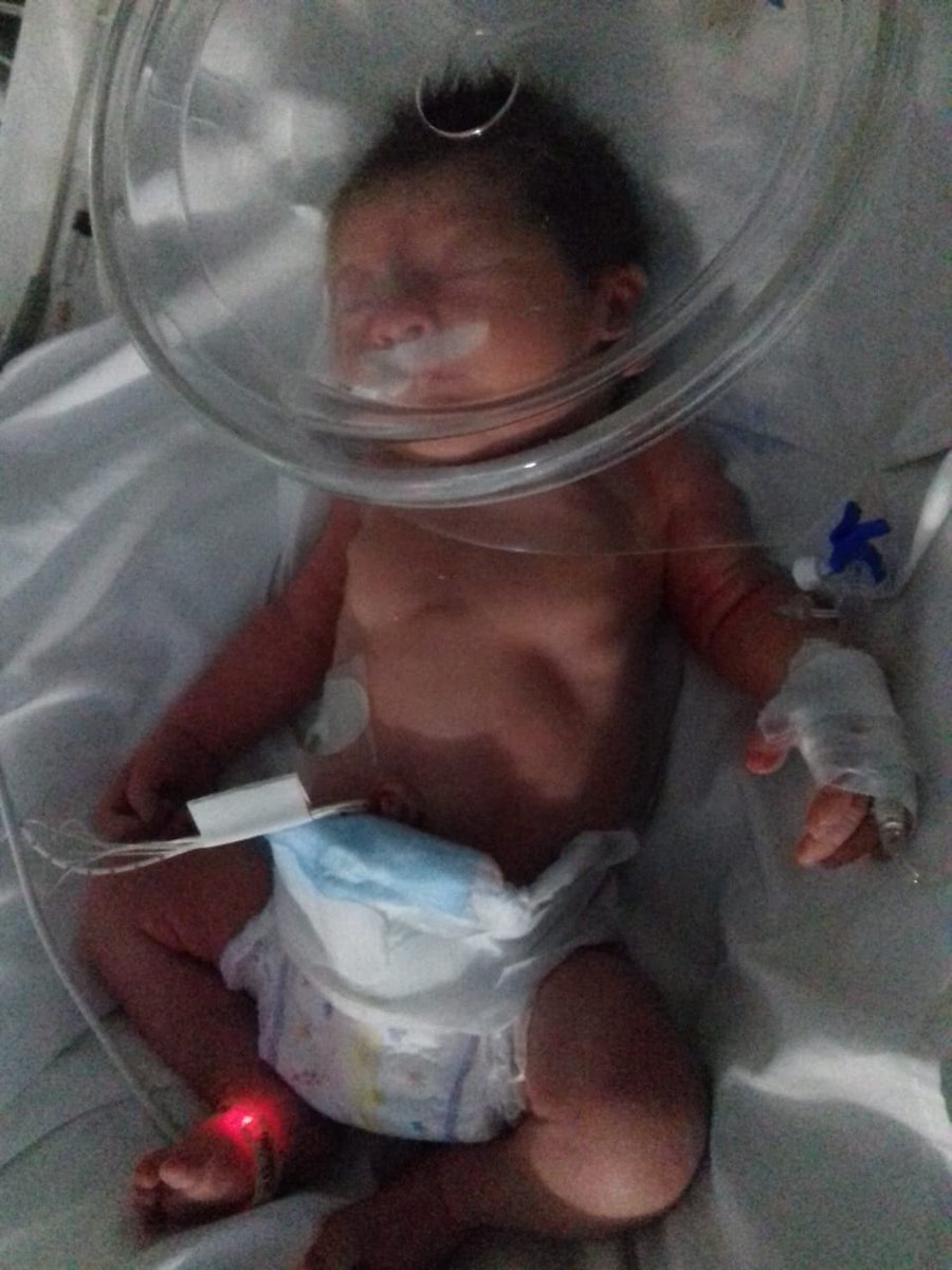 Rosariocastrooo's tweet photo. El es mi sobrino Valentino Benjamín Cuenca,esta muy grave.
Por favor no importa la religión, pido cadena de oración por favor, Compartir 😔 https://t.co/wVkttQ5Zcf