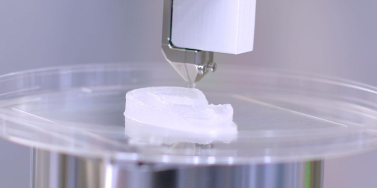 ENGins_Tissue's tweet photo. Landmark Transplant Turns 3D Bioprinting on Its Ear. More than a quarter-century after scientists first grew a humanlike ear on the back of a mouse, surgeons in San Antonio have successfully used a 3D printer to reconstruct... https://t.co/Znbvlr4yxH #TissueEng #YoE #Bio #ENGins https://t.co/1GwPiumTkt