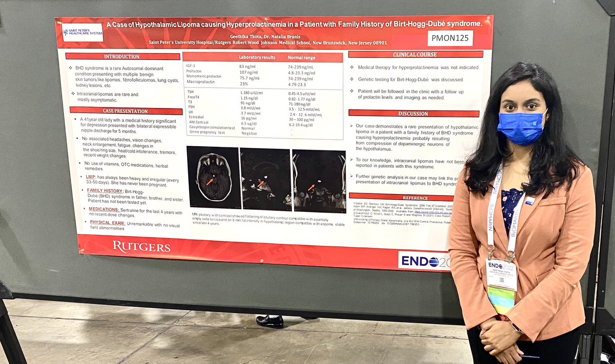 Geethika Thota (@geethikapthota) on Twitter photo Interesting case of Hypothalamic lipoma causing hyperprolactinemia in a patient with Family history of BHD Syndrome. Thanks to Dr.Branis. Special thanks <a href="/TheEndoSociety/">Endocrine Society</a> <a href="/EndoMedia/">EndoMedia</a> #ENDO2022 #Neuroendo #Firsttimeattendee
Direct link to poster 👇
…gcustomers.s3-eu-west-1.amazonaws.com/account1953131… Interesting case of Hypothalamic lipoma causing hyperprolactinemia in a patient with Family history of BHD Syndrome. Thanks to Dr.Branis. Special thanks <a href="/TheEndoSociety/">Endocrine Society</a> <a href="/EndoMedia/">EndoMedia</a> #ENDO2022 #Neuroendo #Firsttimeattendee
Direct link to poster 👇
…gcustomers.s3-eu-west-1.amazonaws.com/account1953131…