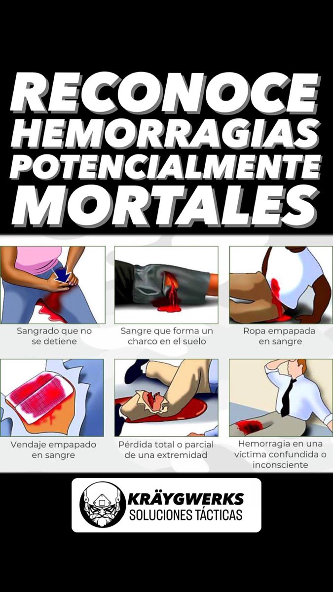 Kraygwerks's tweet photo. Reconociendo hemorragias potencialmente mortales.
Una breve guía para identificar signos inequívocos en lesionados que requieren atención inmediata y aplicación de técnicas para contener hemorragias.
#StopTheBleed
#MedicinaTactica
#TREPH https://t.co/KvI3Nb4J4m