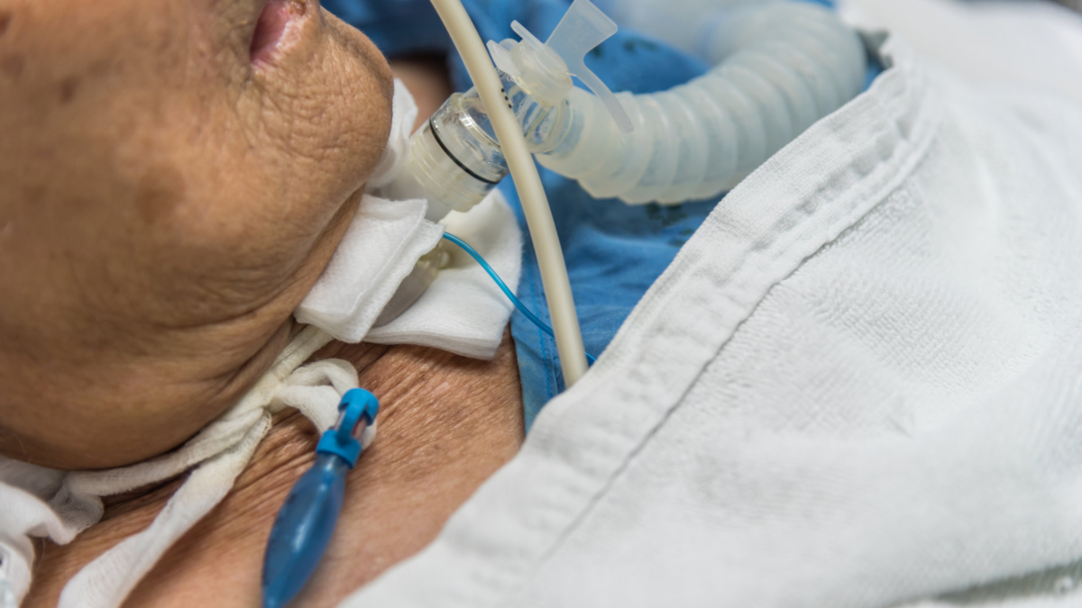 ClinicalXGA's tweet image. Tracheostomy Care

Patients who breathe oxygenated air through ventilators for a long time have an increased likeliness to undergo tracheostomy.

Read more: facebook.com/permalink.php?…

#ClinicalXperts #TracheostomyCare