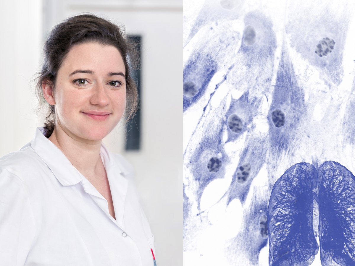 MedUniGraz's tweet photo. #Lungenfibrose: Therapiemöglichkeiten sowie Vorteile und Risiken bestimmter Wirkstoffe im Fokus von @LBG_research und @MedUniGraz. Anna Birnhuber stellt neue Erkenntnisse bei der Anwendung des Medikaments Pirfenidon vor: https://t.co/8hhdPwmlXN https://t.co/TqAPZTe2wp