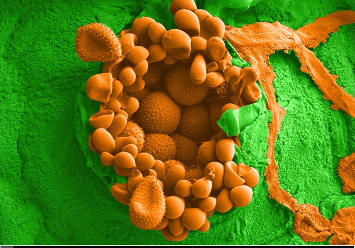 With the community effort, we have compared three genomes of #soybeanrust (genome size &gt;1 GB and ~93% TEs) biorxiv.org/content/10.110…