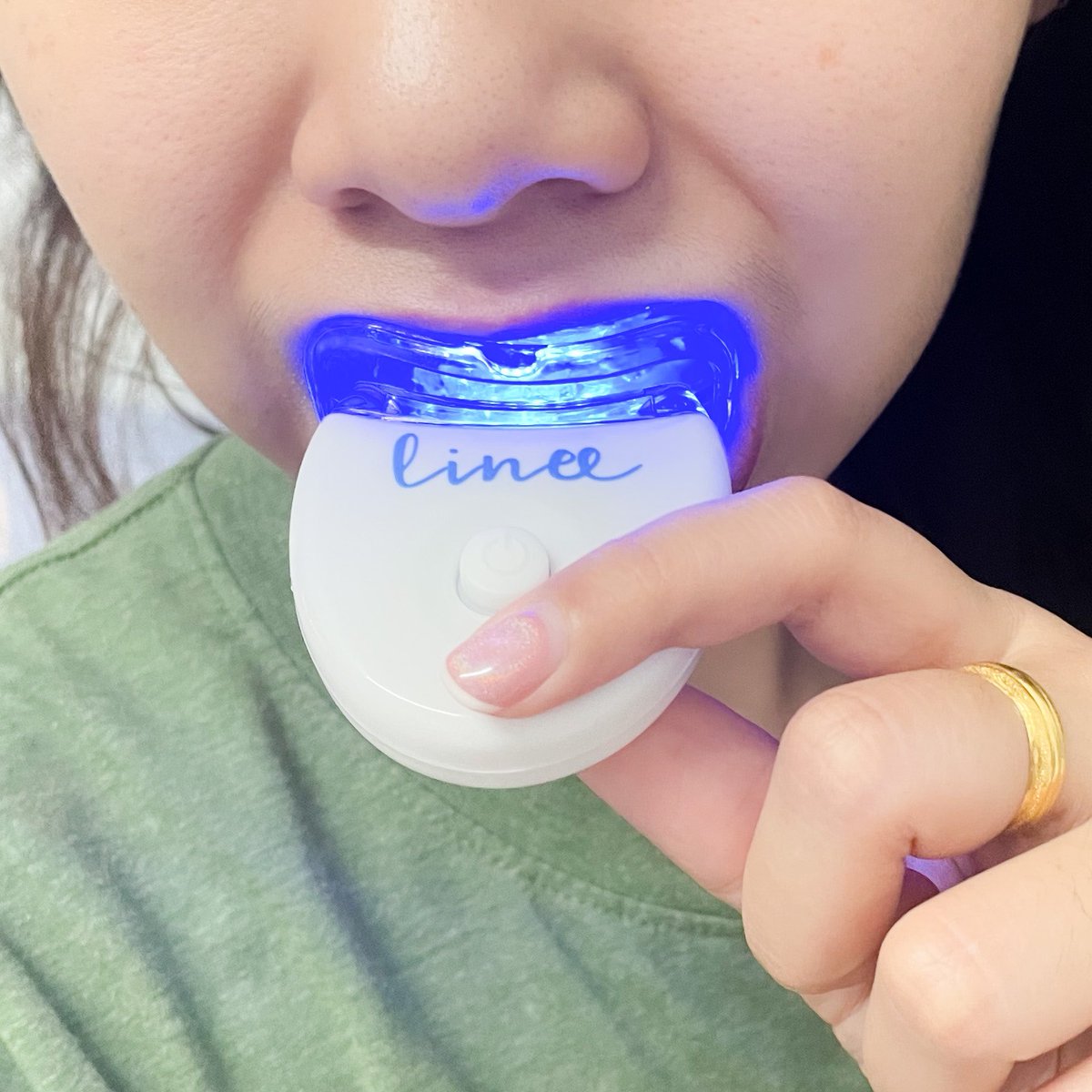 เพิ่งรู้ว่าเครื่องฟอกฟัน linee สามารถใช้กับคนจัดฟันได้ด้วย เจลไม่ทำลายเหล็กจัดฟันไม่เป็นอันตรายด้วย ใช้ง่าย มีบอกขั้นตอนต่างๆ สะดวกสุดๆ ฟอกอยู่บ้านสบายๆแค่ครั้งละ 15นาที ก็ทำให้ฟันเริ่มขาวขึ้นแย้วว 🦷💙#ไว้รีวิวห้ามขายของโว้ยย