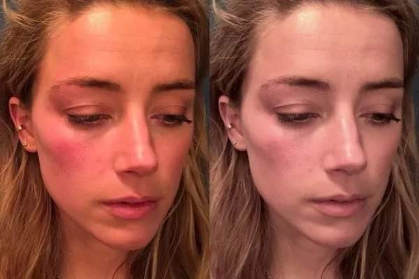 MessyBessy34's tweet photo. Amber Heard: “To my dying day I will stand by every word of my testimony.”

Also Amber Heard: “These are two completely different photos taken on different days in different lighting.”

She expects us to believe her when we watched her lie so blatantly?
 #JusticeForAmberHeard https://t.co/XWsMWvbKEm