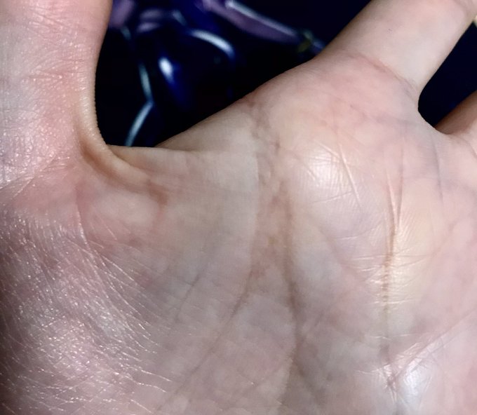 今日急に指摘されたんだが左手の頭脳線と生命線の根元が三つ編みみたいになってて「何これ見たことない!」って言われた。
誰か詳しい人教えてクレメンス 