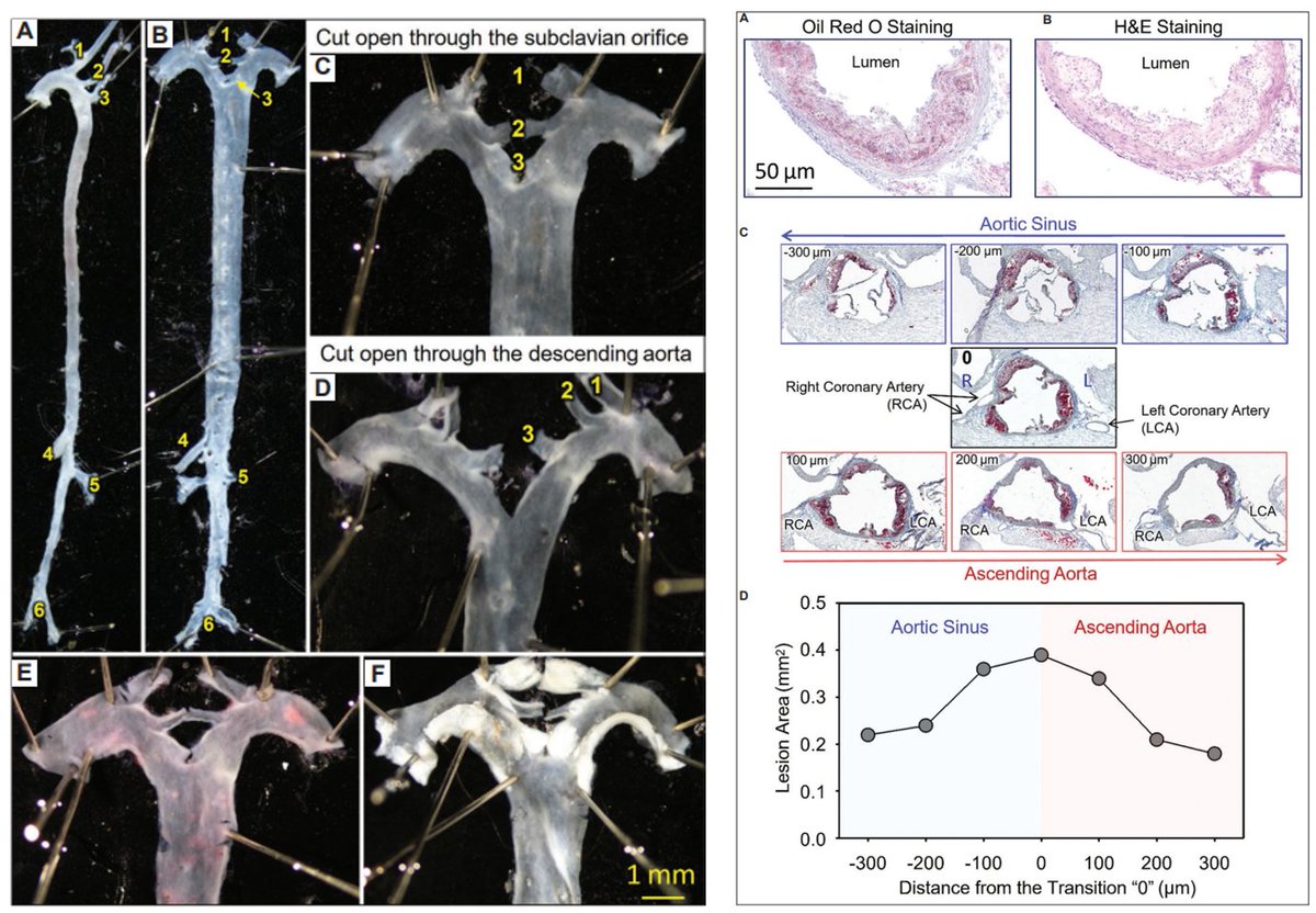 honglu227's tweet image. We introduce our experience in atherosclerosis research using mouse models!  accscience.com/journal/GTM/1/…