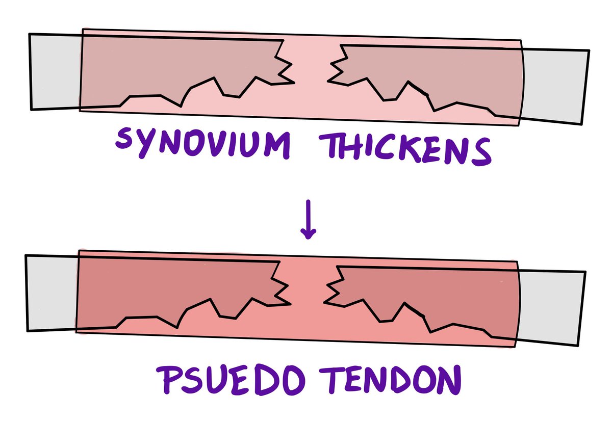 In 2015, my concept of Rheumatoid arthritis was it’s a joints problem. 

7 years later I understand...