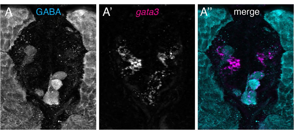 doll_caleb's tweet photo. @MadS100tist @ClutchScience @rburdine1 @ZebrafishRock @hmtchoi gata3 HCR followed by sections and GABA IHC. https://t.co/NN0mv7LaiA