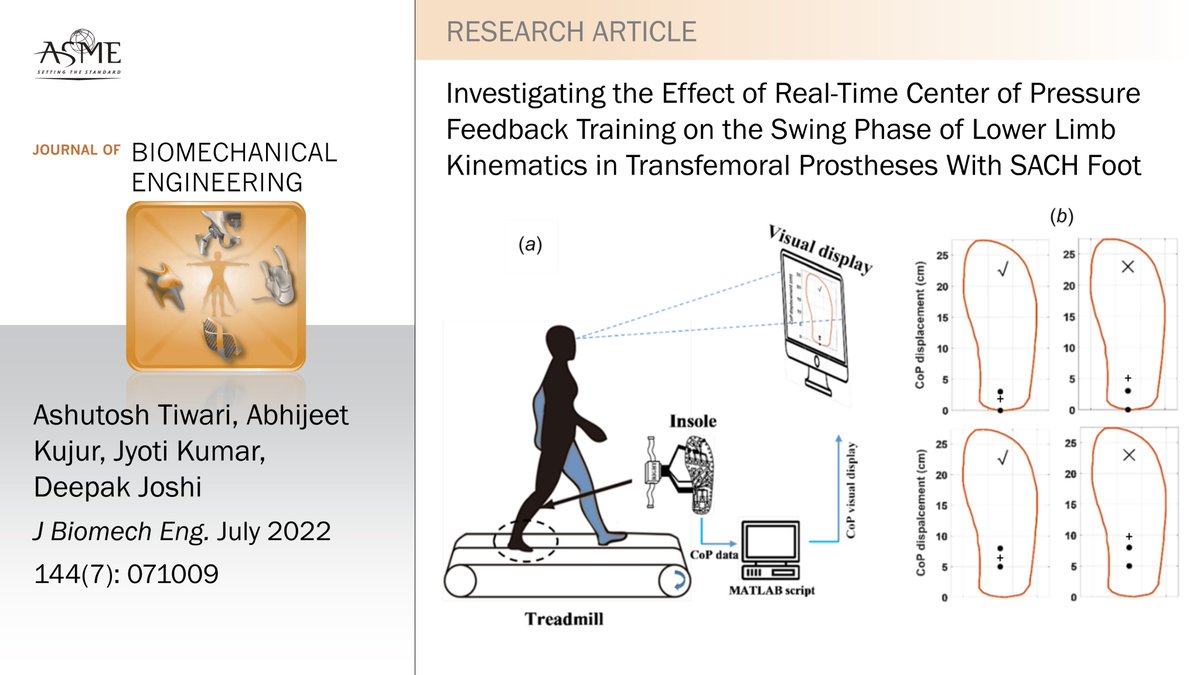 JBMEjournal's tweet photo. #newinJBME Biofeedback training on center of pressure motion may support goal-oriented rehabilitation in transfemoral amputees who have solid ankle cushion heel (SACH) foot prostheses. https://t.co/gkdUbVvhDk https://t.co/5mpWbKj9EL
