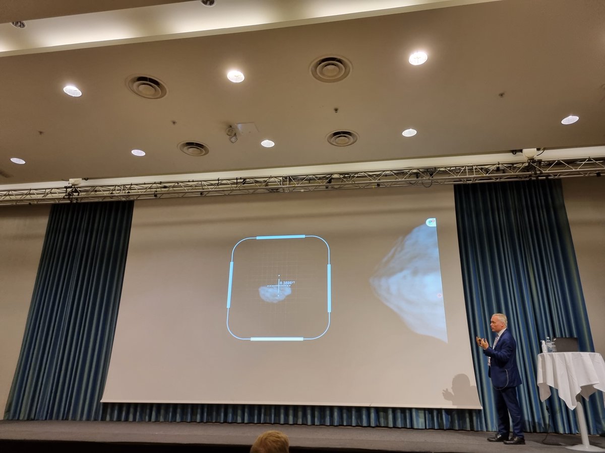 ExtremeNtnu's tweet photo. James Walker from @SwRI at #ICILSM2022: Size Matters; Failure Models can Introduce a Length Scale 
#HypervelocityImpact #DART #DoubleAstroidRedirectionTest https://t.co/5oBrn9Bdwa