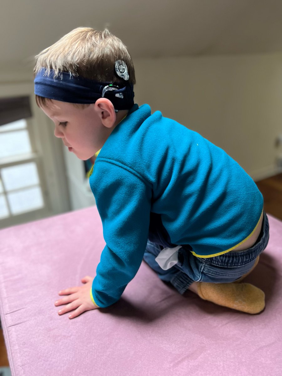 CochlearUS's tweet photo. How sweet are these photos of a #Cochlear recipient and his #soundprocessors?! If you have a photo to share, be sure to tag us! https://t.co/fULxMlZPQX