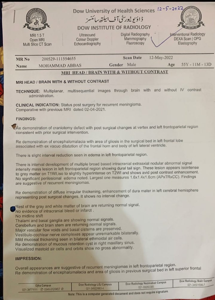 shahdabjunejo's tweet photo. 📢 Donation Request 📢

My maternal uncle Muhammad Abbas was diagnosed with brain tumor meningioma Grade-1 in 2012, 2015 and 2019. He had underwent through craniotomy and excision from AKHU thrice at his family expense. 1/4 https://t.co/Bnylb1gbn6