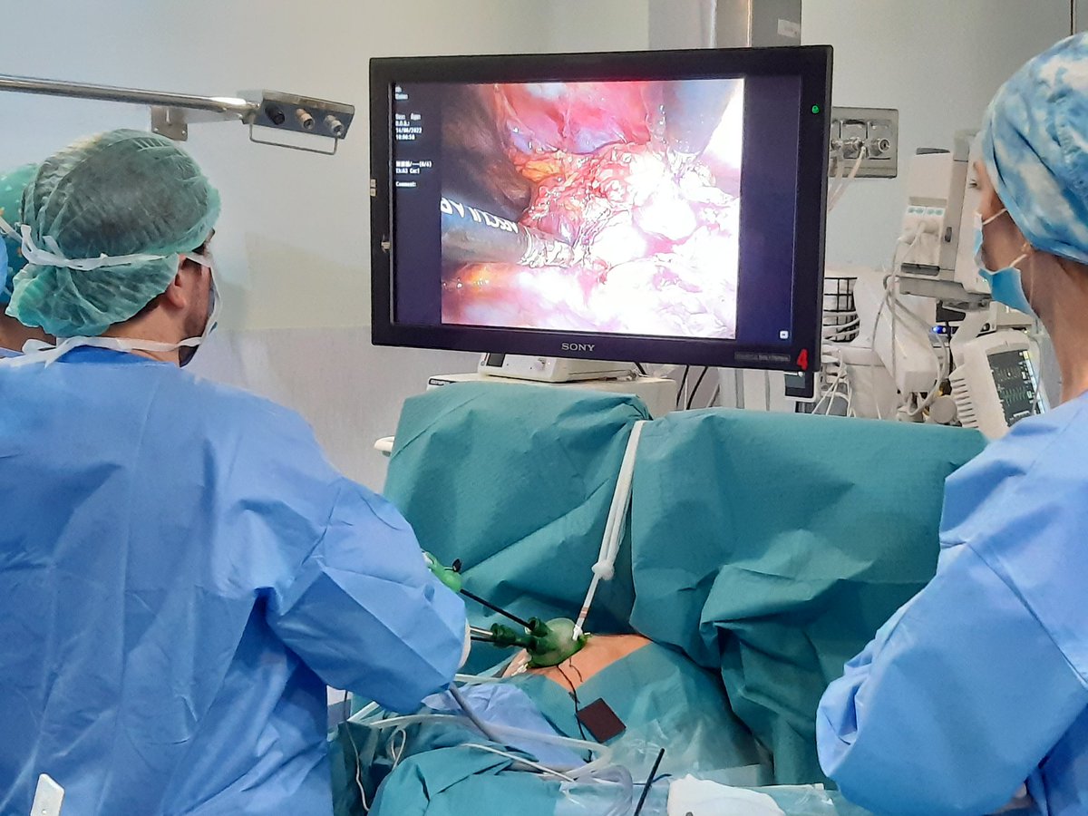 TTrueta's tweet photo. Primera timectomia subxifoidea per miastènia gravis realitzada al Trueta, amb la col.laboració Dr. Sànchez (H. Clínic)
#mínimainvasio
#granequip 
@TTrueta @htrueta @hospitalclinic @ThorSurgHClinic https://t.co/JGmHMFg4wq