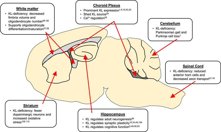 📢we're back with another review paper to promote 📢

In #BPLjournal vol. 3 no. 2, Dr. Hai T. Vo et al. broadly reviewed how the klotho protein effects the brain, including roles in neurogenesis and synaptic plasticity, and as a therapeutic target. 

content.iospress.com/articles/brain…