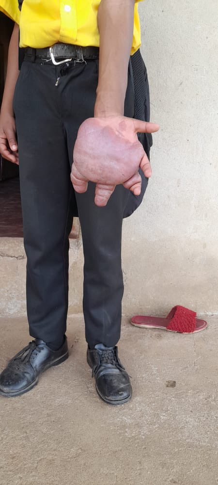 ZARnewsOnline's tweet image. The Nene family in Mtubatuba are pleading for medical intervention for their child (11). The young boy has crippling pain in his hand and has not been able to receive any assistance from the local health facilities he has been taken to.

Channel 261, 7pm.