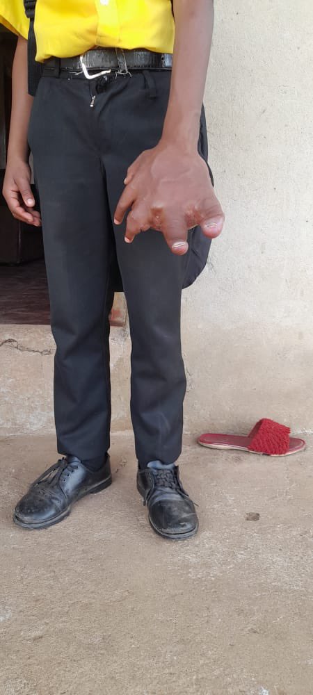 ZARnewsOnline's tweet image. The Nene family in Mtubatuba are pleading for medical intervention for their child (11). The young boy has crippling pain in his hand and has not been able to receive any assistance from the local health facilities he has been taken to.

Channel 261, 7pm.