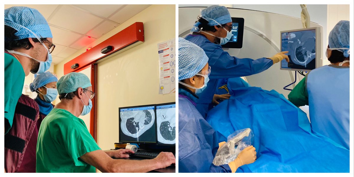 cirsesociety's tweet photo. Mentoring by Prof. Gaubert to excellent fellows @axel_bartoli and Dr. Lu and dedicated nurse anesthesists #InterventionalOncology #ECIO (4/7) https://t.co/607cKn2tml