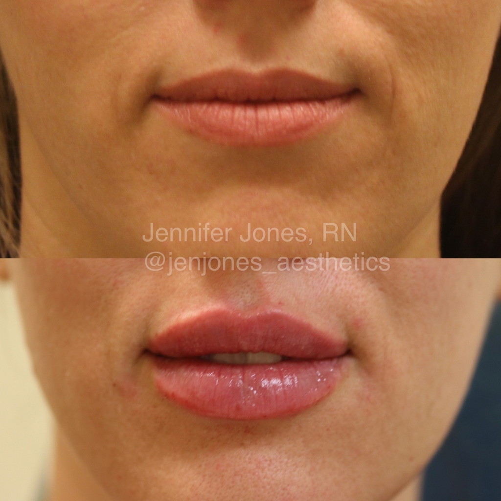 Nayak Plastic Surgery & Avani Derm Spa tweet media