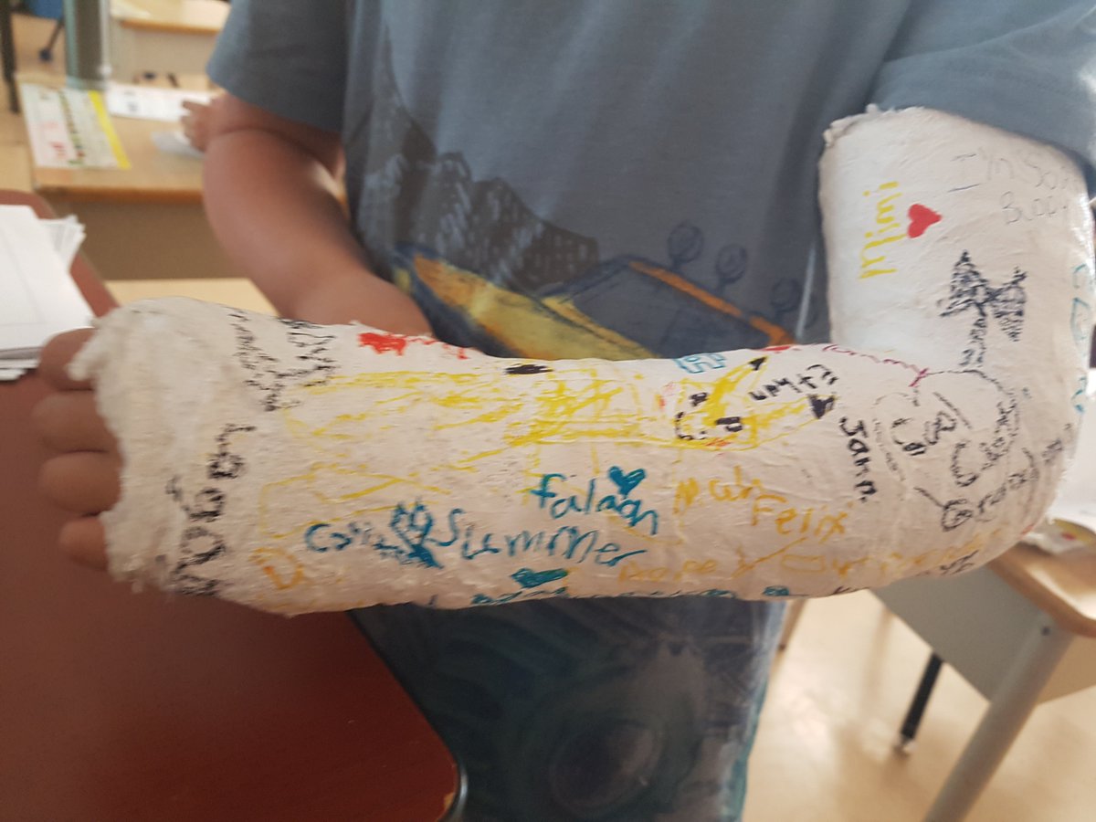 MsEPrice15's tweet photo. We always make time to sign a friend's cast. Feel better soon L. @BayridgePS_LDSB https://t.co/WpkEgpuKNk