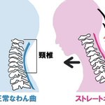 ストレートネック民はこれやって!「首のつけ根」をほぐして「背中」を丸めるべし!