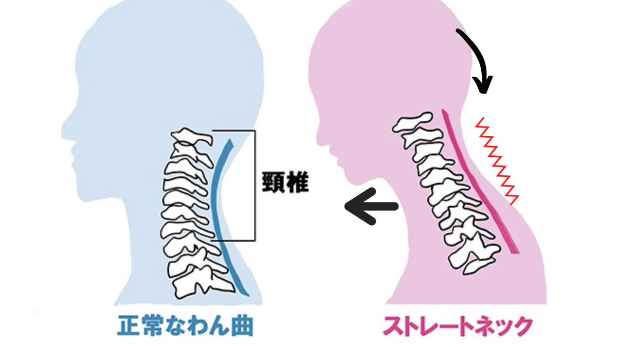 ストレートネック民はこれやって！「首のつけ根」をほぐして「背中」を丸めるべし！