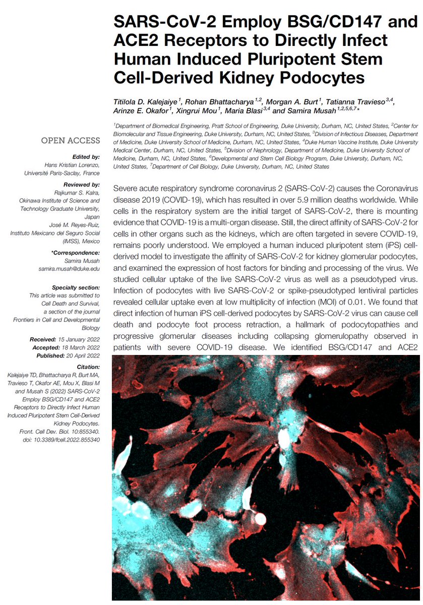 MusahLab's tweet photo. We are excited to share a new #publication from our lab! Led by @TitiLolaKaleja1 and highlighted TWICE in @Forbes, we revealed how #COVID-19 damages #kidney #cells. Big thanks to our wonderful @TheDHVI collaborator, @MariaBlasi6!
https://t.co/lAB9QepBvG https://t.co/LJWRTN5uuf